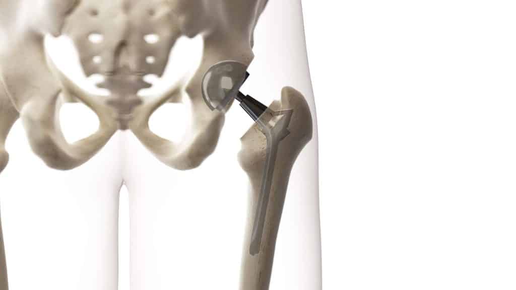 Medical Applications_3Axis