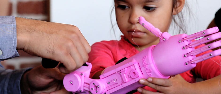 PROSTHETIC Isabella With Team Of Engineer And Designers Fathom